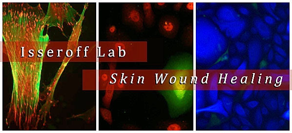 Isseroff Lab Skin Wound Healing (c) UC Regents. All rights reserved.