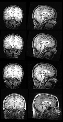 Image of head scan