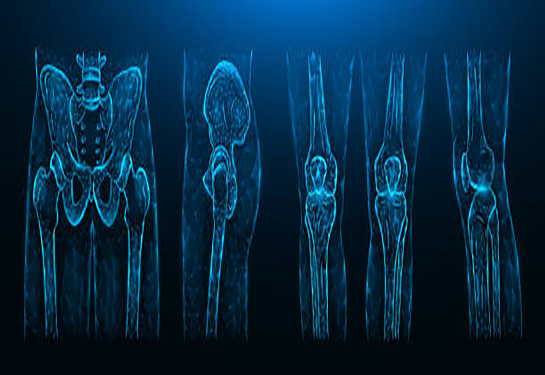 Xray of four sections of human skeleton