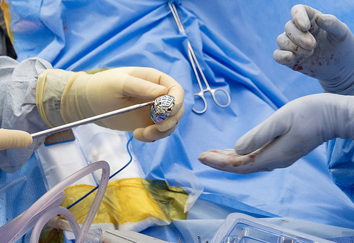Surgeon Mariano Menendez and the surgical team prepare the implements during Mora's shoulder replacement. 