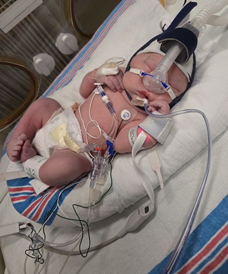 Baby in a hospital bed with wires and breathing apparatus.