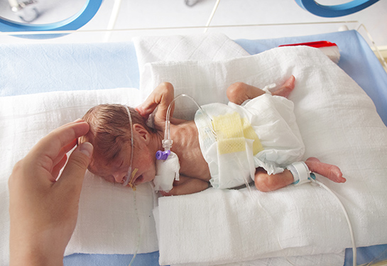 A baby lies in the Neonatal Intensive Care Unit