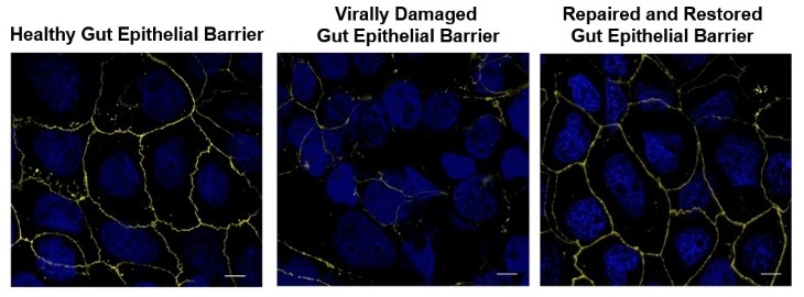 Microscopy images show gut epithelial barrier integrity in healthy, damaged, and repaired states.