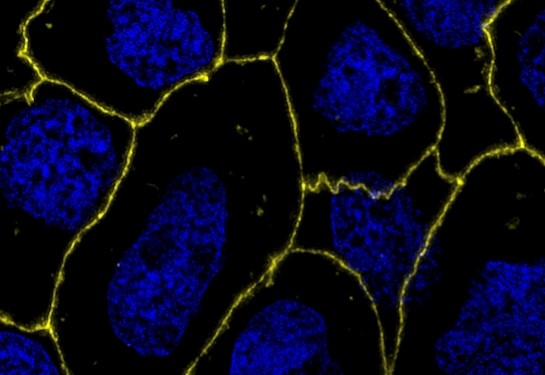 Fluorescence microscopy image of cells with blue-stained nuclei and yellow-outlined cell membranes on a black background.