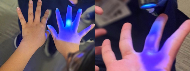 Pediatric residents participate in a Glo Germ exercise that provides visual feedback on handwashing technique and highlights commonly missed areas