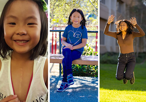 Image 1: Annabelle shows scar from heart surgery. Image 2: Annabelle sits on bench wearing blue shirt that says “Heart of gold.” Image 3: Annabelle jumps into the air.
