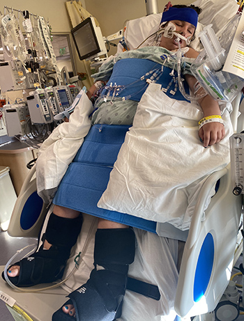 Callie in the hospital on ECMO, a heart-lung bypass machine