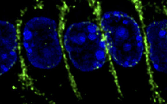 Cells seen under a microscope.