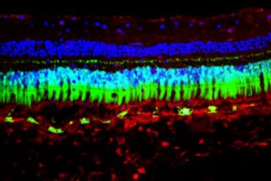 Imaging of eye showing layers of red, blue, and green colors.