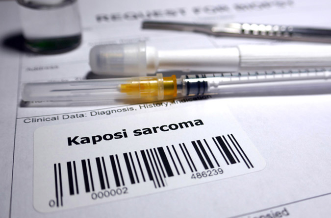 A paper with barcode that says kaposi sarcoma.