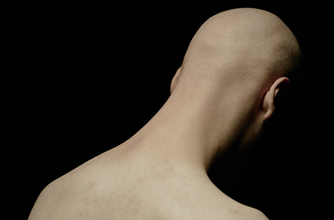 Person with shaved head and bare neck.