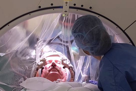 Patient laying down during robotic neurosurgery procedure.