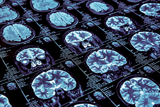 Brain scans.
