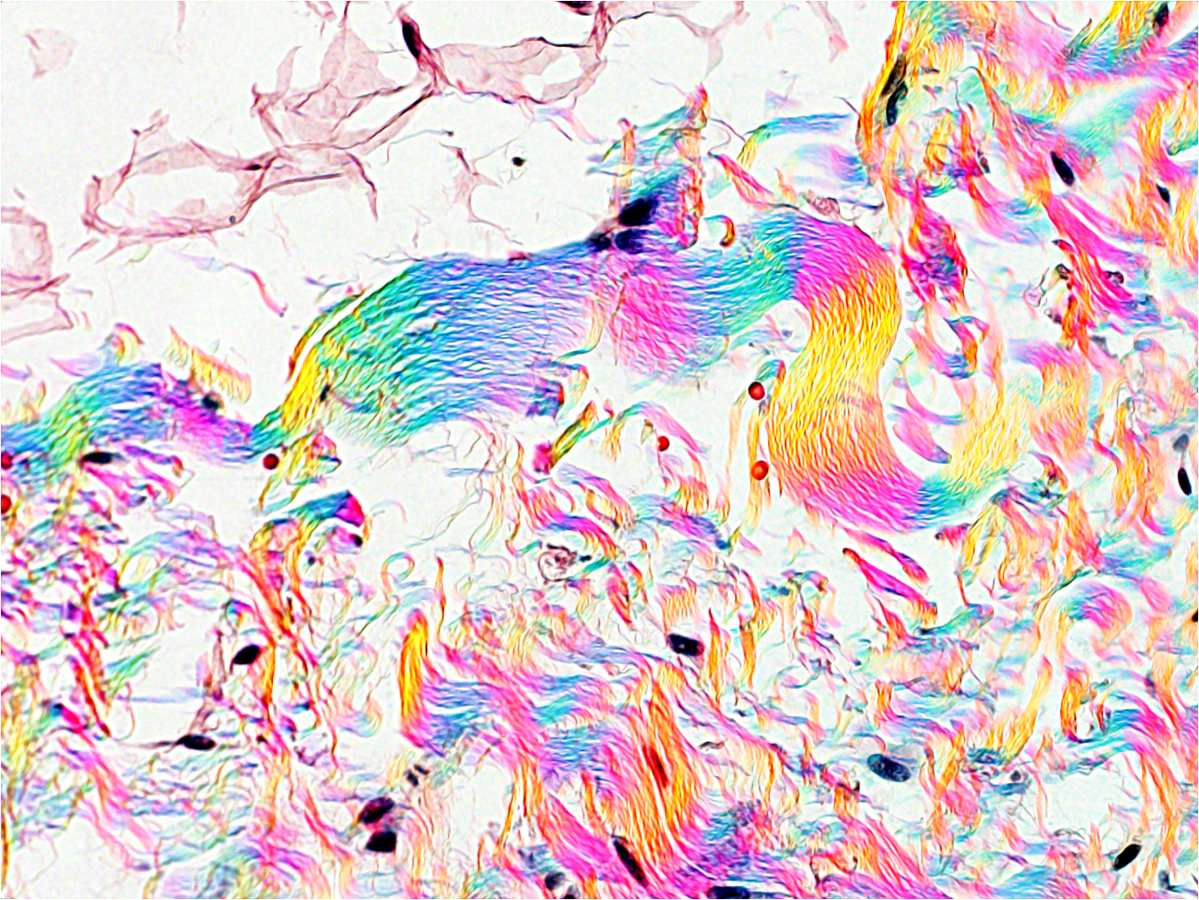 microscope image of collagen in breast tissue