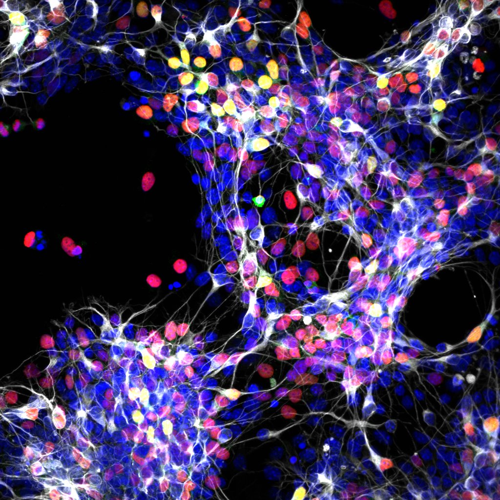 microscopy image depicting neurons differentiating from progenitor cells in a cell culture