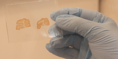 A gloved hand holding a microscope slide with small tissue samples