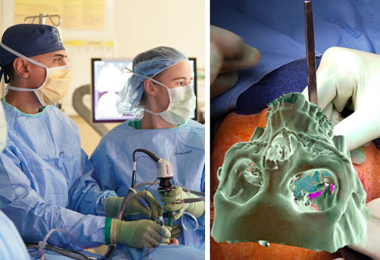 Skull Base Surgery