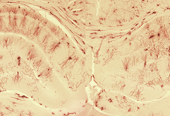 brain neurons