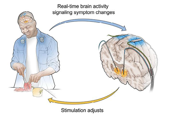 brain stimulation model