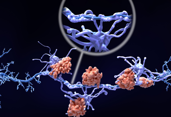 oligodendrocytes