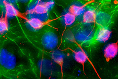 Stem cell