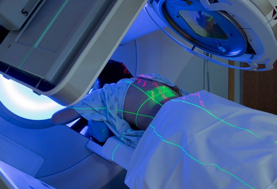 Woman lying face down on treatment table, receiving radiation therapy for cancer
