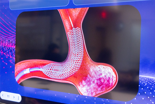An example on a computer screen of a mesh diverter that surgeons implant in the brain to treat aneurysms. (c) UC Regents