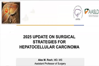 2025 Update on Surgical Strategies for Hepatocellular Carcinoma