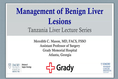 Management of Benign Liver Lesions