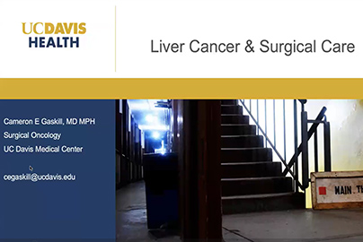 Liver Cancer and Surgical Care