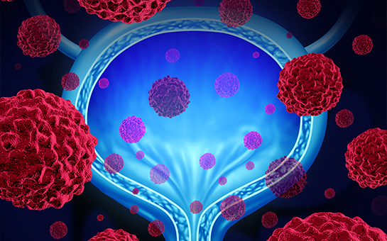 Bladder cancer clinical  trial is region’s first