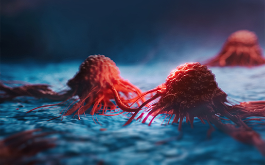 Clinical trial shows  biomarkers hold clue  in treating aggressive  prostate cancer