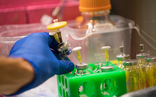 $2 million grant fuels UC Davis fight against pancreatic cancer