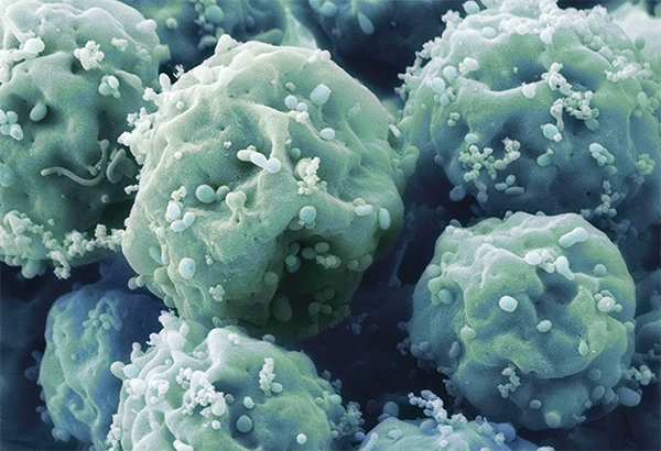 Lucchesi Research cancer cell